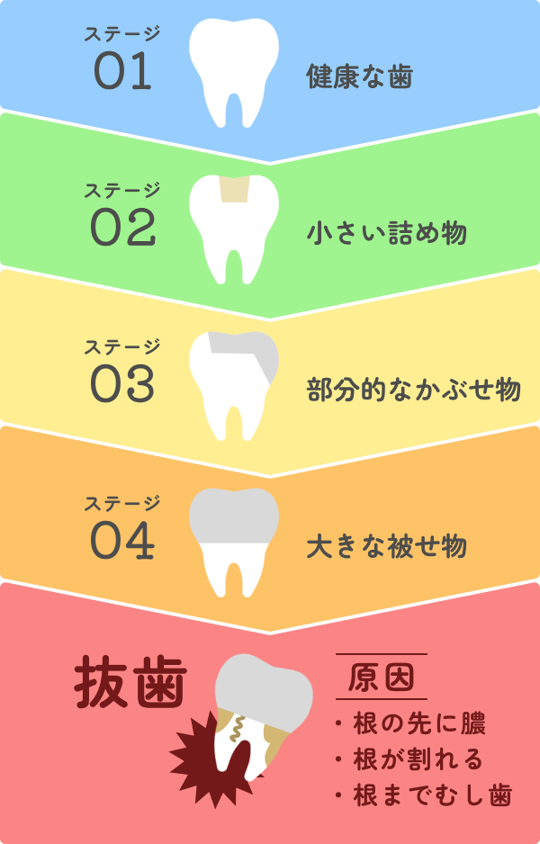 抜歯までの流れ